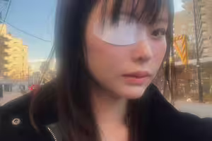 變成獨眼龍！松本麗鈴(原 明日見未来)被前男友打到受傷。